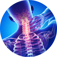 Arthrose et ostéoporose
